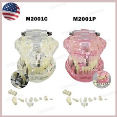 US Dental Model Upper Lower Jaw 4 Overdenture Practice Implant Typodont Demo