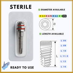 Spiral Dental Fixture | Internal Hex 2.42mm | Titanium Grade 5 SLA | MDI Dental