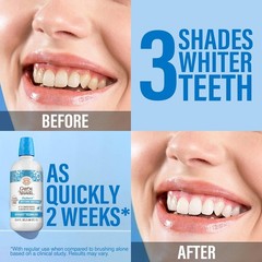 GuruNanda Oxyburst Teeth Whitening Mouthwash – Alcohol & Fluoride Free, with H