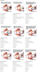 Dental Ortho Polish Strips Interproximal Enamel Reduction IPR Strip Serrated Saw