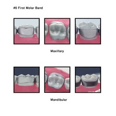 J&J Ortho™ Orthodontic #6 First Molar Band Quadrant (4/pk) Optional Size