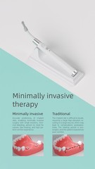 Dental Implant Detector Surgical Locator 360° Rotating Smart Finder Tool Sensor