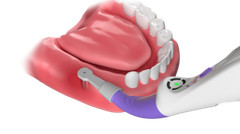 Dental Implant Spotter Locator Detector 3D Easydo Surgical 270°Spotting Finder