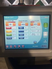 2015 Deka Smartxide Mona Lisa – Fractional CO2, Vaginal Rejuvenation