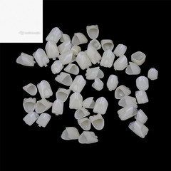 120 Pcs False Teeth Crown Veneers Anterior Posterior Set with Thermal Beads Cap