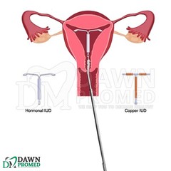 5 Pcs Set IUD Extractor Hook 10.25″ Dual Grasping Hooks OB/GYN Inst German Grade