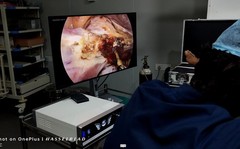 4k Endoscopy Laparoscopic Camera System UHD-LP-6000 Ultra HD Endoscope Camera