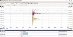 NVH Noise Oscilloscope Leads For Pico Or Any BNC Connection. Noise & Vibration.