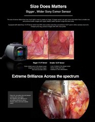 Laparoscopic Camera for Surgical Laparoscopy Endoscopy Full HD Endoscope Systems