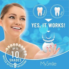 MySmile Teeth Whitening Kit with LED Light, 10 Min 3 Fl Oz (Pack of 3)