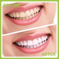 Professional Dental Tools Kit Teeth Cleaning Tartar Scraper Personal Pet Use