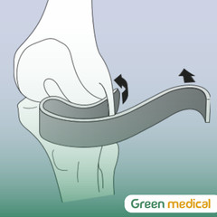 S-Shaped Total Knee Retractors – Orthopedic TKA Surgical Instrument