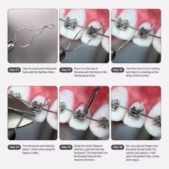 Dental Orthodontic Kobayashi Preformed Wire Metal Ligature Ties Short Long Twist
