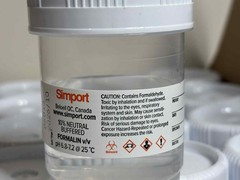 Simport HistoTainer II 120mL Prefilled Specimen Containers Case of 96 M961-120FW