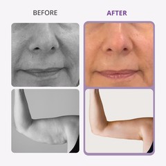 9in1 Beauty Machine for Body Massage Facial Skin Care Boost Contour Lost Weigk8
