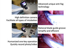 Digital laryngoscope Video laryngoscope with reusable disinfectable blade color