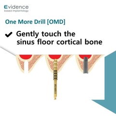 Evidence Implant One More Drill [OMD]