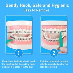 YYING Orthodontic Rubber Bands for Braces 1/8” Light 3.5 oz, 100 Pcs Dental …