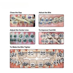 5000pcs Dental Ortho Elastic Rubber Bands 3.5/5.0/6.5 OZ Latex Braces Zoo Pack