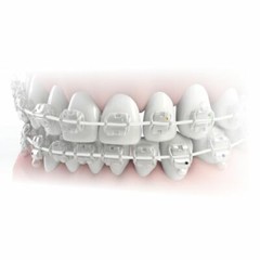 Morelli NiTi Dental White Orthodontic Archwire Superelastic Aesthetic 5 Wires