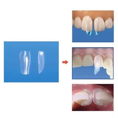 Dental Clear Matrix TOR VM Anterior Matrices Bow BT Fits Bioclear Matrice L/M/S