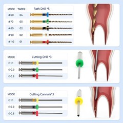 Dental Broken File Extractor Endodontic File Removal System Kit Endo Root Canal