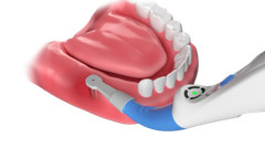 Dental Implant Spotter Locator Detector 3D Easydo Surgical 270°Spotting Finder