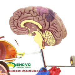 Medical Anatomical Human Diabetes Model 8 Parts Shows The Harm Of Diabetes