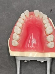 Kilgore Nissin Dental Model Typodont P15DP-TR.56C.1-QF Periodontal Hygiene Board