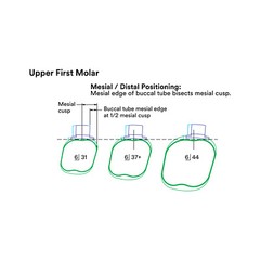 J&J Ortho™ Orthodontic #6 First Molar Band Quadrant (4/pk) Optional Size