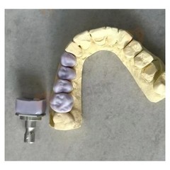 US C14 Emax Glass Ceramic Blocks HT LT Lithium Disilicate CAD/CAM Cerec 5Pcs/Box