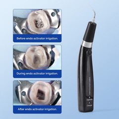 Dental Endo Ultrasonic Activator Ultra Root Canal Irrigator Handpiece with 6Tips