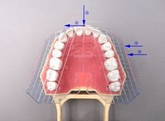 Dental Guide Template Plate For Complete Denture False Teeth Arrangement