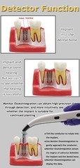 DENTAL ISQ IMPLANT STABILITY METER TOOL INSTRUMENT