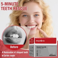 Tooth Repair Kit Zinc Oxide Eugenol,Dental Cement for Chipped Broken Teeth, Miss