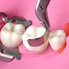 Dental Matrix Bands Ring Sectional Matrix System Tulwar Wedges Fit Palodent V3