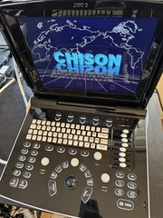 Chison Eco 3 with Convex Abdominal Probe