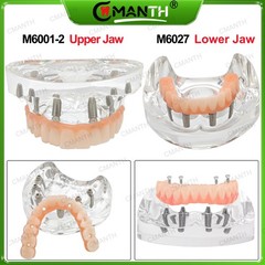 Multiple Types Dental Teeth Model Ortho Implant Practice Teaching Demo Model