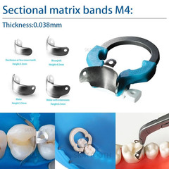 Dental Matrix Bands Ring Sectional Matrice Clamp Fit Palodent V3 Garrison