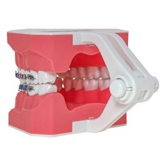 US Dental Typodont Ortho Teeth Model With Metal Braces for Brushing Practice