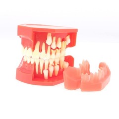 Teeth Typodont Dental Model – Eruption Development, Deciduous Teeth, Dental Educ