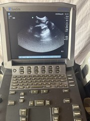 SonoSite M-turbo Portable Vet Ultrasound w/ C11x & P21x Transducer Probe