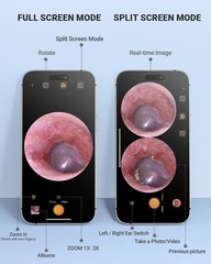 Digital Otoscope Compatible with iPhone and Android Devices Video Ear Scope
