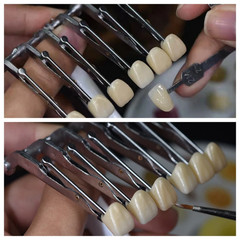 Dental Veneer Porcelain False Teeth Clip Veneer Glazing Clip Crown Holder Clamp