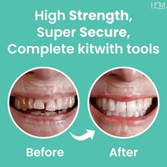Zinc Oxide Eugenol Dental Cement Kit for Instant Tooth Repairs at Home