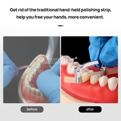 Dental Polishing Strip Coarse Medium Fine 50/30/20μm Polishing Resin Restoration