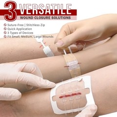 EVERLIT CARE Wound Closure Kit | For Up to 6″ Cuts & Lacerations, Transparent