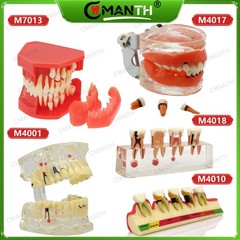 Multiple Types Dental Teeth Model Ortho Implant Practice Teaching Demo Model