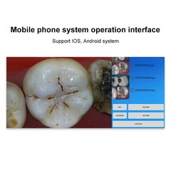 Dental Wireless Oral Viewer Intraoral Camera 1080p HD Intra Oral Camera