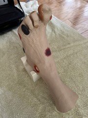 VATA Wilma Wound Foot Teaching Model